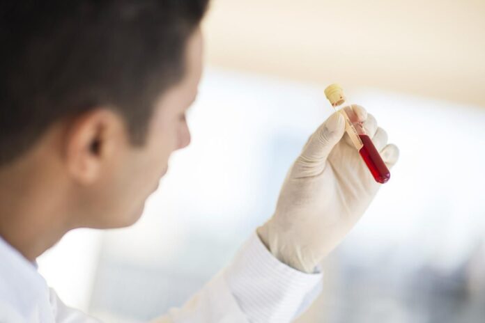 Regular Lab Tests. A laboratory technician holding a vial with blood